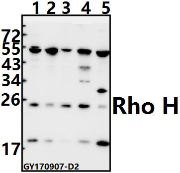 Western blot (WB) analysis of Rho H (M134) pAb at 1:500 dilution
Lane1:HEK293T whole cell lysate(20ug)
Lane2:HepG2 whole cell lysate(20ug)
Lane3:Hela whole cell lysate(20ug)
Lane4:C6 whole cell lysate(40ug)
Lane5:CT26 whole cell lysate(40ug)