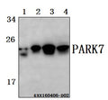 Western blot (WB) analysis of PARK7 (A87) polyclonal antibody at 1:500 dilution
Lane1:Hela whole cell lysate(40ug)
Lane2:L02 whole cell lysate(40ug)
Lane3:HEK293T whole cell lysate(40ug)
Lane4:The kidney tissue lysate of Rat(40ug)