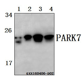 Western blot (WB) analysis of PARK7 (A87) polyclonal antibody at 1:500 dilution
Lane1:Hela whole cell lysate(40ug)
Lane2:L02 whole cell lysate(40ug)
Lane3:HEK293T whole cell lysate(40ug)
Lane4:The kidney tissue lysate of Rat(40ug)