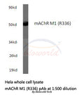 Western blot (WB) analysis of mAChR M1 (R336) polyclonal antibody in extracts from hela cells.