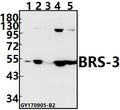 Western blot (WB) analysis of BRS-3 (C203) pAb at 1:500 dilution
Lane1:A549 whole cell lysate(10ug)
Lane2:Panc1 whole cell lysate(10ug)
Lane3:BV2 whole cell lysate(40ug)
Lane4:H9C2 whole cell lysate(40ug)
Lane5:PC12 whole cell lysate(40ug)