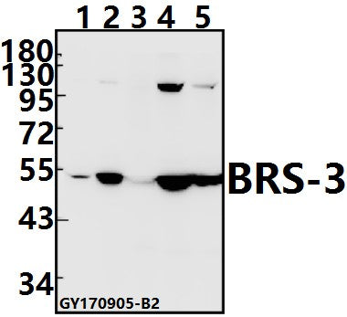 Western blot (WB) analysis of BRS-3 (C203) pAb at 1:500 dilution
Lane1:A549 whole cell lysate(10ug)
Lane2:Panc1 whole cell lysate(10ug)
Lane3:BV2 whole cell lysate(40ug)
Lane4:H9C2 whole cell lysate(40ug)
Lane5:PC12 whole cell lysate(40ug)