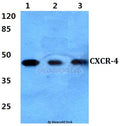 Western blot (WB) analysis of CXCR-4 (V340) polyclonal antibody at 1:500 dilution
Lane1:Hela cell lysate 
Lane2:Raw264.7 cell lysate
Lane3:H9C2 cell lysate