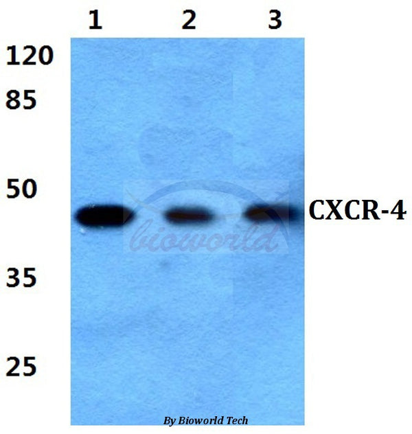 Western blot (WB) analysis of CXCR-4 (V340) polyclonal antibody at 1:500 dilution
Lane1:Hela cell lysate 
Lane2:Raw264.7 cell lysate
Lane3:H9C2 cell lysate