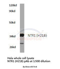 Western blot (WB) analysis of NTR1 (H218) polyclonal antibody in extracts from hela cells.