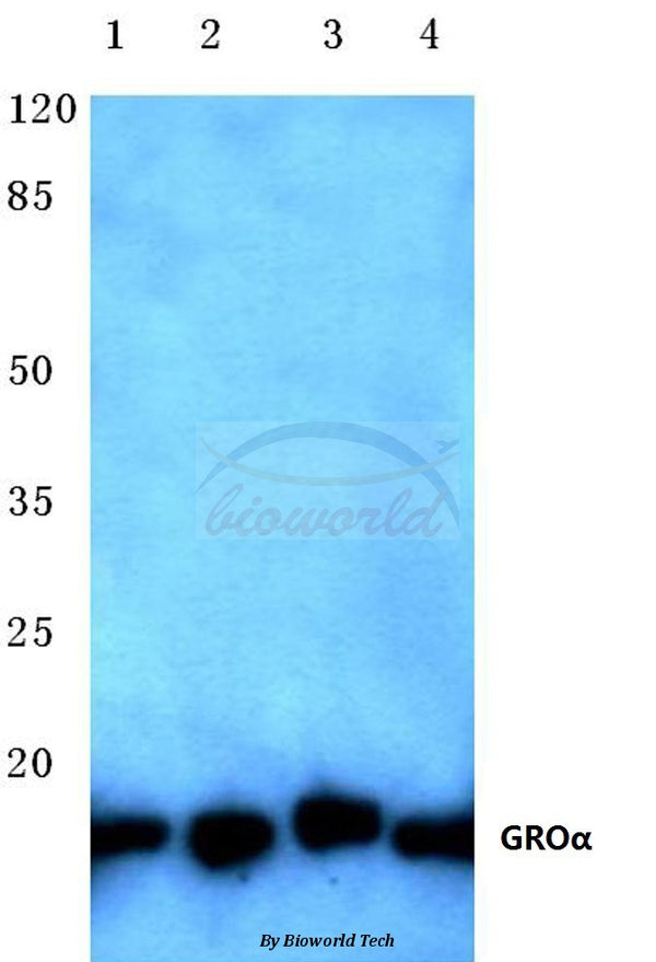 Western blot (WB) analysis of GROα (P88) polyclonal antibody at 1:500 dilution
Lane1:Jurkat cell lysate
Lane2:HEK293T cell lysate
Lane3:Mouse heart tissue lysate
Lane4:Rat brain tissue lysate