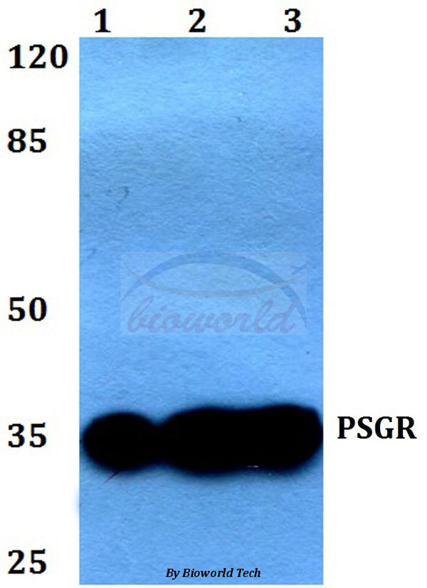 Western blot (WB) analysis of PSGR (F237) polyclonal antibody at 1:500 dilution
Lane1:Jurkat whole cell lysate
Lane2:Raw264.7 whole cell lysate
Lane3:PC12 whole cell lysate