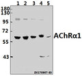 Western blot (WB) analysis of AChRα1 (E217) pAb at 1:500 dilution
Lane1:HepG2 whole cell lysate(40ug)
Lane2:A549 whole cell lysate(40ug)
Lane3:PC3 whole cell lysate(40ug)
Lane4:CT26 whole cell lysate(40ug)
Lane5:H9C2 whole cell lysate(40ug)