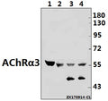 Western blot (WB) analysis of AChRα3 (L139) pAb at 1:500 dilution
Lane1:The Brain tissue lysate of Mouse(40ug)
Lane2:C6 whole cell lysate(40ug)
Lane3:A549 whole cell lysate(40ug)
Lane4:Hela whole cell lysate(40ug)
