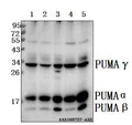 Western blot (WB) analysis of PUMA (R169) polyclonal antibody at 1:500 dilution
Lane1:L02 whole cell lysate(40ug)
Lane2:HepG2 whole cell lysate(40ug)
Lane3:MCF-7 whole cell lysate(40ug)
Lane4:PC12 whole cell lysate(40ug)
Lane5:BV2 whole cell lysate(40ug)