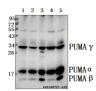 Western blot (WB) analysis of PUMA (R169) polyclonal antibody at 1:500 dilution
Lane1:L02 whole cell lysate(40ug)
Lane2:HepG2 whole cell lysate(40ug)
Lane3:MCF-7 whole cell lysate(40ug)
Lane4:PC12 whole cell lysate(40ug)
Lane5:BV2 whole cell lysate(40ug)