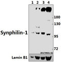 Western blot (WB) analysis of Synphilin-1 (R846) pAb at 1:500 dilution
Lane1:3T3-L1 whole cell lysate(40ug)
Lane2:C6 whole cell lysate(40ug)
Lane3:Hela whole cell lysate(40ug)
Lane4:HEK293T whole cell lysate(40ug)