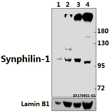 Western blot (WB) analysis of Synphilin-1 (R846) pAb at 1:500 dilution
Lane1:3T3-L1 whole cell lysate(40ug)
Lane2:C6 whole cell lysate(40ug)
Lane3:Hela whole cell lysate(40ug)
Lane4:HEK293T whole cell lysate(40ug)