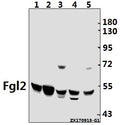 Western blot (WB) analysis of Fgl2 (V38) pAb at 1:500 dilution
Lane1:CT26 whole cell lysate(40ug)
Lane2:SP2/0 whole cell lysate(40ug)
Lane3:C6 whole cell lysate(40ug)
Lane4:A549 whole cell lysate(40ug)
Lane5:Hela whole cell lysate(40ug)