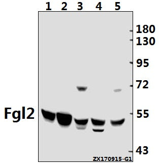 Western blot (WB) analysis of Fgl2 (V38) pAb at 1:500 dilution
Lane1:CT26 whole cell lysate(40ug)
Lane2:SP2/0 whole cell lysate(40ug)
Lane3:C6 whole cell lysate(40ug)
Lane4:A549 whole cell lysate(40ug)
Lane5:Hela whole cell lysate(40ug)
