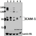 Western blot (WB) analysis of ICAM-1 (Q506) pAb at 1:500 dilution
Lane1:HEK293T whole cell lysate(20ug)
Lane2:A549 whole cell lysate(40ug)
Lane3:H1792 whole cell lysate(40ug)
Lane4:C6 whole cell lysate(40ug)
Lane5:SP2/0 whole cell lysate(40ug)