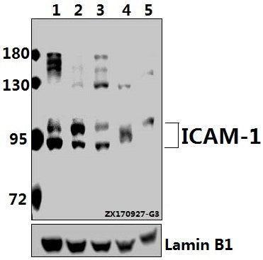 Western blot (WB) analysis of ICAM-1 (Q506) pAb at 1:500 dilution
Lane1:HEK293T whole cell lysate(20ug)
Lane2:A549 whole cell lysate(40ug)
Lane3:H1792 whole cell lysate(40ug)
Lane4:C6 whole cell lysate(40ug)
Lane5:SP2/0 whole cell lysate(40ug)