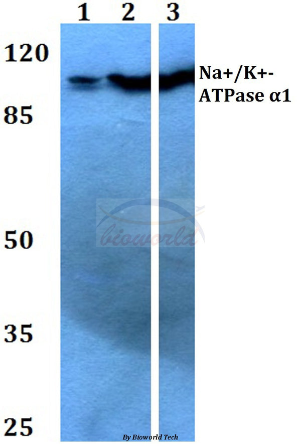 Na+/K+-ATPase α1 (G19) polyclonal antibody – Figure 1 of 1