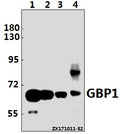 Western blot (WB) analysis of GBP1 (E99) pAb at 1:1000 dilution
Lane1:HEK293T whole cell lysate(10ug)
Lane2:HCT116 whole cell lysate(10ug)
Lane3:The Kidney tissue lysate of Rat(20ug)
Lane4:The Kidney tissue lysate of Mouse(40ug)