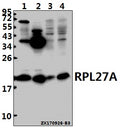 Western blot (WB) analysis of RPL27A (V140) pAb at 1:500 dilution
Lane1:Hela whole cell lysate(40ug)
Lane2:MCF-7 whole cell lysate(40ug)
Lane3:The Brain tissue lysate of Mouse(40ug)
Lane4:The Brain tissue lysate of Rat(40ug)