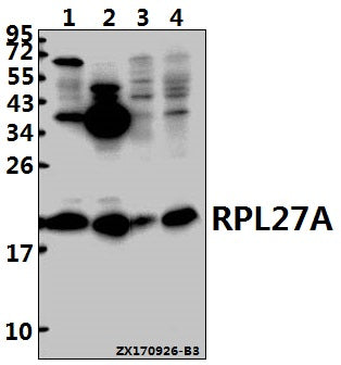 Western blot (WB) analysis of RPL27A (V140) pAb at 1:500 dilution
Lane1:Hela whole cell lysate(40ug)
Lane2:MCF-7 whole cell lysate(40ug)
Lane3:The Brain tissue lysate of Mouse(40ug)
Lane4:The Brain tissue lysate of Rat(40ug)