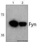 Western blot (WB) analysis of Fyn (K207) polyclonal antibody at 1:500 dilution
Lane1:The brain tissue lysate of Mouse(30ug)
Lane2:The brain tissue lysate of Rat(40ug)
