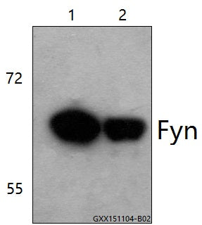 Western blot (WB) analysis of Fyn (K207) polyclonal antibody at 1:500 dilution
Lane1:The brain tissue lysate of Mouse(30ug)
Lane2:The brain tissue lysate of Rat(40ug)