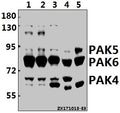 Western blot (WB) analysis of PAK4/5/6 (V469) pAb at 1:500 dilution
Lane1:H1792 whole cell lysate(20ug)
Lane2:MCF-7 whole cell lysate(20ug)
Lane3:PC3 whole cell lysate(20ug)
Lane4:The Testis tissue lysate of Mouse(40ug)
Lane5:The Testis tissue lysate of Rat(40ug)