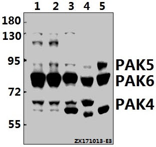 Western blot (WB) analysis of PAK4/5/6 (V469) pAb at 1:500 dilution
Lane1:H1792 whole cell lysate(20ug)
Lane2:MCF-7 whole cell lysate(20ug)
Lane3:PC3 whole cell lysate(20ug)
Lane4:The Testis tissue lysate of Mouse(40ug)
Lane5:The Testis tissue lysate of Rat(40ug)