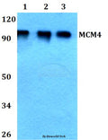 Western blot (WB) analysis of MCM4 (P50) polyclonal antibody at 1:500 dilution
Lane1:HEK293T whole cell lysate
Lane2:Raw264.7 whole cell lysate
Lane3:PC12 whole cell lysate