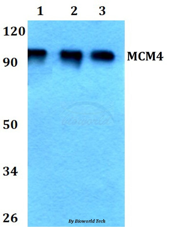Western blot (WB) analysis of MCM4 (P50) polyclonal antibody at 1:500 dilution
Lane1:HEK293T whole cell lysate
Lane2:Raw264.7 whole cell lysate
Lane3:PC12 whole cell lysate