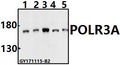 Western blot (WB) analysis of POLR3A (P68) pAb at 1:500 dilution
Lane1:PC3 whole cell lysate(40ug)
Lane2:Hela whole cell lysate(40ug)
Lane3:K562 whole cell lysate(40ug)
Lane4:C6 whole cell lysate(40ug)
Lane5:BV2 whole cell lysate(40ug)