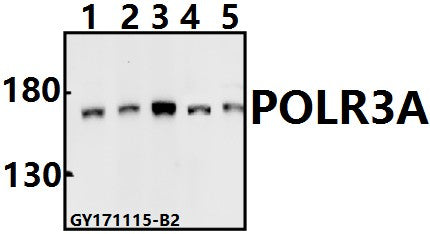 Western blot (WB) analysis of POLR3A (P68) pAb at 1:500 dilution
Lane1:PC3 whole cell lysate(40ug)
Lane2:Hela whole cell lysate(40ug)
Lane3:K562 whole cell lysate(40ug)
Lane4:C6 whole cell lysate(40ug)
Lane5:BV2 whole cell lysate(40ug)