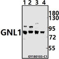 Western blot (WB) analysis of GNL1 (Q103) pAb at 1:1000 dilution
Lane1:The Brain tissue lysate of Mouse(40ug)
Lane2:The Brain tissue lysate of Rat(40ug)
Lane3:HEK293T whole cell lysate(40ug)
Lane4:MCF-7 whole cell lysate(40ug)