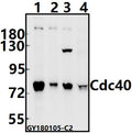 Western blot (WB) analysis of Cdc40 (S209) pAb at 1:500 dilution
Lane1:HEK293T whole cell lysate(10ug)
Lane2:MCF-7 whole cell lysate(10ug)
Lane3:CT26 whole cell lysate(10ug)
Lane4:The Brain tissue lysate of Rat(40ug)