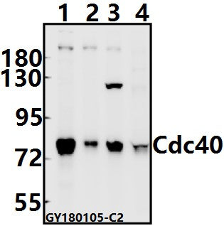 Western blot (WB) analysis of Cdc40 (S209) pAb at 1:500 dilution
Lane1:HEK293T whole cell lysate(10ug)
Lane2:MCF-7 whole cell lysate(10ug)
Lane3:CT26 whole cell lysate(10ug)
Lane4:The Brain tissue lysate of Rat(40ug)