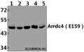 Western blot (WB) analysis of Arrdc4 (E159) pAb at 1:500 dilution
Lane1:Panc1 whole cell lysate(40µg)
Lane2:SGC7901 whole cell lysate(40µg)
Lane3:A549 whole cell lysate(40µg)
Lane4:PC3 whole cell lysate(40µg)
Lane5:HCC827 whole cell lysate(40µg)