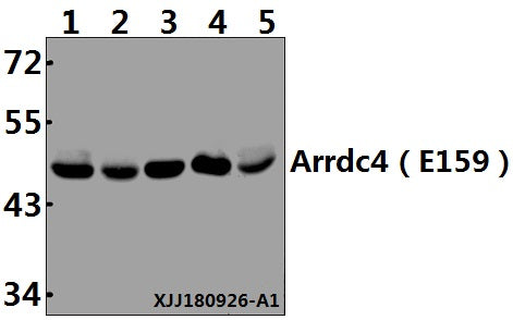 Western blot (WB) analysis of Arrdc4 (E159) pAb at 1:500 dilution
Lane1:Panc1 whole cell lysate(40µg)
Lane2:SGC7901 whole cell lysate(40µg)
Lane3:A549 whole cell lysate(40µg)
Lane4:PC3 whole cell lysate(40µg)
Lane5:HCC827 whole cell lysate(40µg)