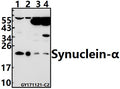 Western blot (WB) analysis of Synuclein-α (D119) pAb at 1:500 dilution
Lane1:SK-OVCAR3 whole cell lysate(40ug)
Lane2:HEK293T whole cell lysate(10ug)
Lane3:The Brain tissue lysate of Mouse(40ug)
Lane4:The Brain tissue lysate of Rat(40ug)