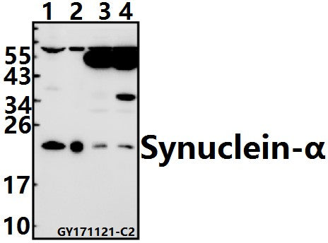 Western blot (WB) analysis of Synuclein-α (D119) pAb at 1:500 dilution
Lane1:SK-OVCAR3 whole cell lysate(40ug)
Lane2:HEK293T whole cell lysate(10ug)
Lane3:The Brain tissue lysate of Mouse(40ug)
Lane4:The Brain tissue lysate of Rat(40ug)