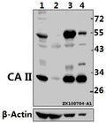Western blot (WB) analysis of CA II (N229) pAb at 1:500 dilution
Lane1:HCT116 whole cell lysate(40ug)
Lane2:The Kidney tissue lysate of Mouse(40ug)
Lane3:The Brain tissue lysate of Rat(20ug)
Lane4:HEK293T whole cell lysate(10ug)