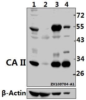 Western blot (WB) analysis of CA II (N229) pAb at 1:500 dilution
Lane1:HCT116 whole cell lysate(40ug)
Lane2:The Kidney tissue lysate of Mouse(40ug)
Lane3:The Brain tissue lysate of Rat(20ug)
Lane4:HEK293T whole cell lysate(10ug)