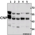Western blot (WB) analysis of CNP pAb at 1:1000 dilution
Lane1:The Brain tissue lysate of Mouse(40ug)
Lane2:PC12 whole cell lysate(40ug)
Lane3:CT-26 whole cell lysate(40ug)
Lane4:SGC7901 whole cell lysate(40ug)
Lane5:K562 whole cell lysate(40ug)