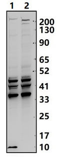 IL-8 (V68) polyclonal antibody – Figure 1 of 1