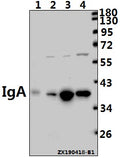 Western blot (WB) analysis of IGHA1/IGHA2 pAb at 1:1000 dilution
Lane1:AML-12 whole cell lysate(40ug)
Lane2:SGC7901 whole cell lysate(40ug)
Lane3:A549 whole cell lysate(40ug)
Lane4:HepG2 whole cell lysate(40ug)