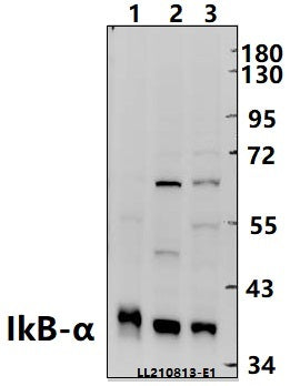 Western blot (WB) analysis of IkB-α (S36) polyclonal antibody at 1:1000 dilution
Lane1:MEF whole cell lysate(40ug)
Lane2:MCF-7 whole cell lysate(40ug)
Lane3:HepG2 whole cell lysate(40ug)