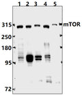 Western blot (WB) analysis of mTOR (S2442) pAb at 1:500 dilution
Lane1:Hela whole cell lysate(40ug)
Lane2:MCF-7 whole cell lysate(40ug)
Lane3:HEK293T whole cell lysate(40ug)
Lane4:C6 whole cell lysate(40ug)
Lane5:AML-12 whole cell lysate(40ug)
