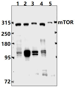 Western blot (WB) analysis of mTOR (S2442) pAb at 1:500 dilution
Lane1:Hela whole cell lysate(40ug)
Lane2:MCF-7 whole cell lysate(40ug)
Lane3:HEK293T whole cell lysate(40ug)
Lane4:C6 whole cell lysate(40ug)
Lane5:AML-12 whole cell lysate(40ug)