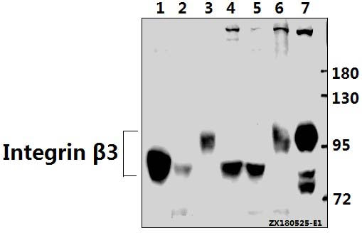 Western blot (WB) analysis of Integrin β3 (S778) pAb at 1:500 dilution
Lane1:BV2 whole cell lysate(40ug)
Lane2:RAW264.7 whole cell lysate(40ug)
Lane3:The Uterus tissue lysate of Rat(40ug)
Lane4:THP-1 whole cell lysate(40ug)
Lane5:A549 whole cell lysate(40ug)
Lane6:PC3 whole cell lysate(40ug)
Lane7:U-87MG whole cell lysate(40ug)