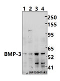 Western blot (WB) analysis of BMP-3 (E306) polyclonal antibody at 1:1000 dilution
Lane1:CT26 whole cell lysate(30ug)
Lane2:PC12 whole cell lysate(30ug)
Lane3:HepG2 whole cell lysate(30ug)
Lane4:A549 whole cell lysate(30ug